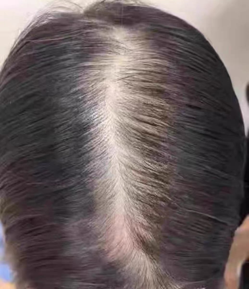 Dermalight customer before and after 4