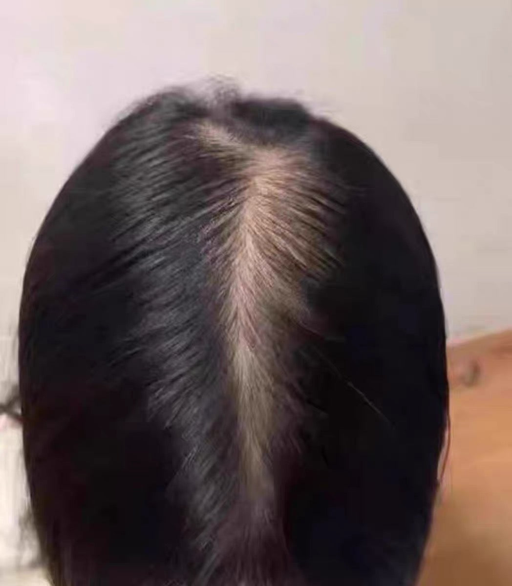 Dermalight customer before and after 5